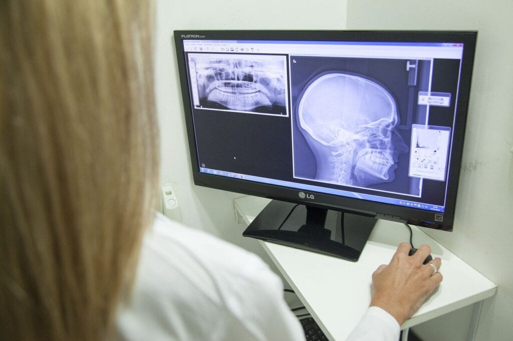 Ärztin schaut sich einen Scan an.