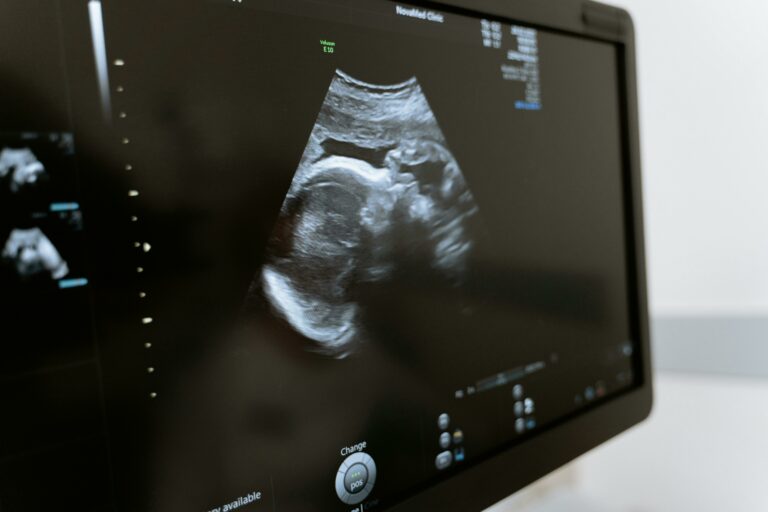 Das Bild einer Ultraschalluntersuchung auf einem Monitor.